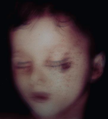 Helnwein Child: Gottfried Helnwein, Poem 1, photograph, 1996