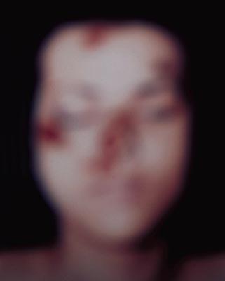 Helnwein Child: Gottfried Helnwein, Poem 11, photograph, 1997